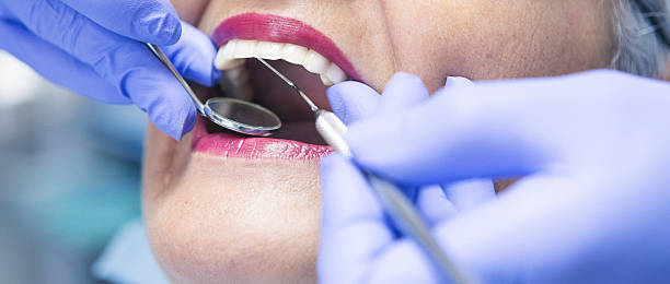 Best Emergency Dentist for Lost Fillings or Crowns in Cross Lanes, WV